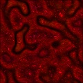 Coagulated Blood Bath