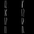 Variation 4