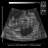 UltraSound v1.1