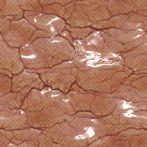 Variation 1