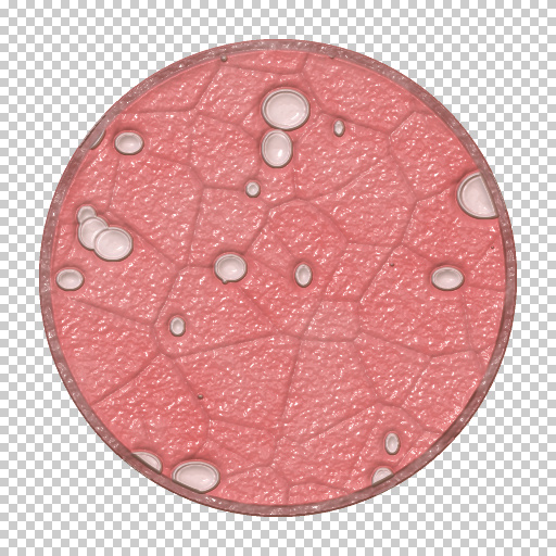 Variation 1