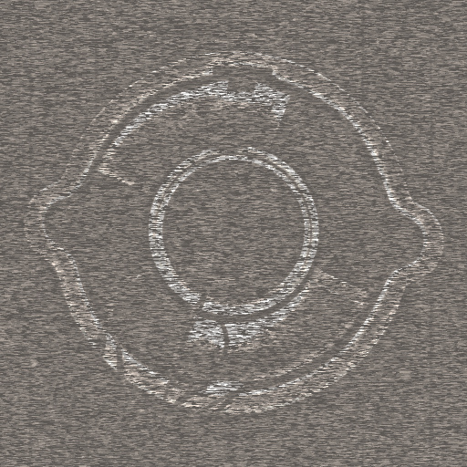Variation 3