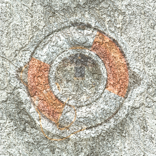 Variation 1
