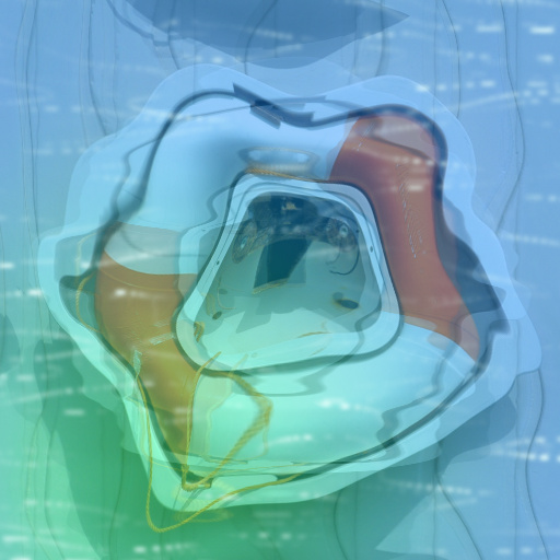 Variation 2