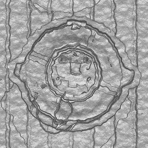 Ambient Occlusion Map