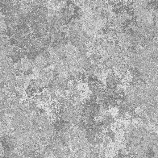 Rotten_Plaster