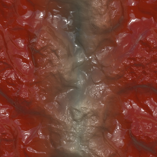 Colon Cancer (Texture)