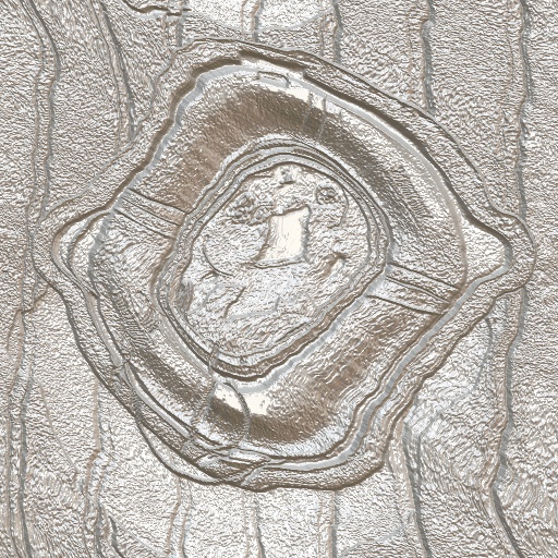 Variation 2