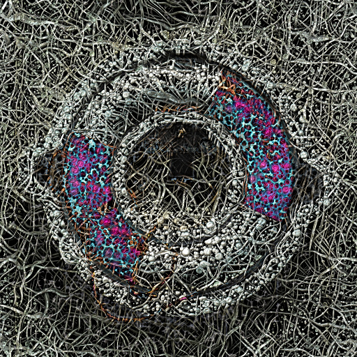 Variation 4