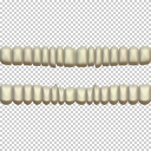 Variation 1
