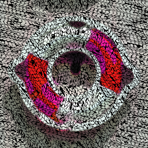 Variation 1
