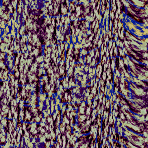 Variation 1