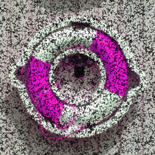 Variation 6