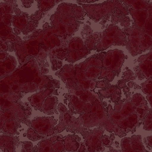 Variation 5