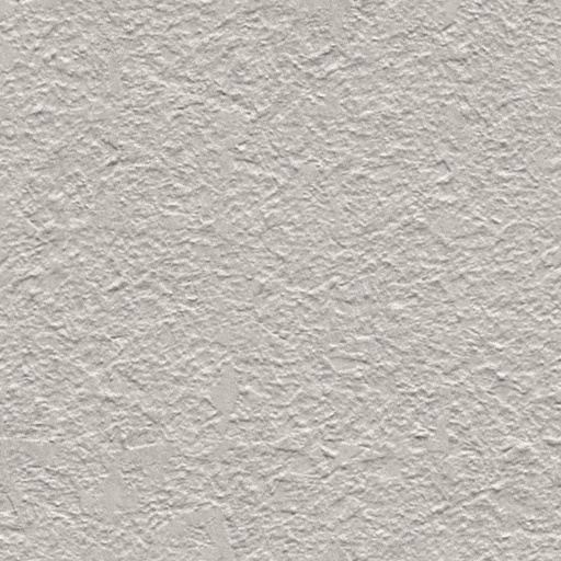 Rey's Plaster (Texture)