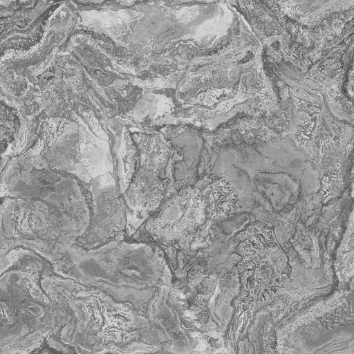 Metallic Map