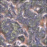 Milky Rocks