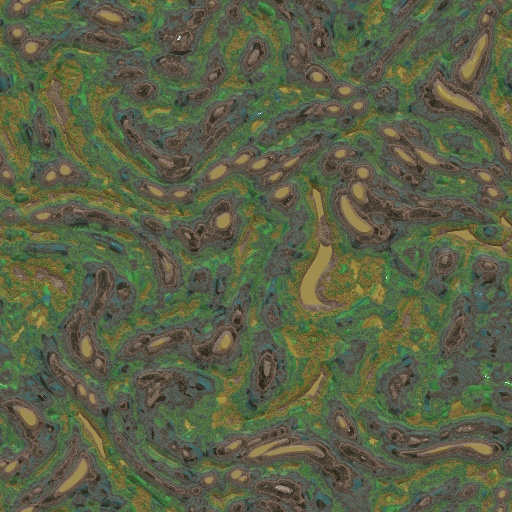 Variation 2