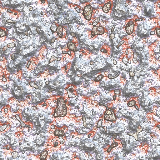 Variation 6