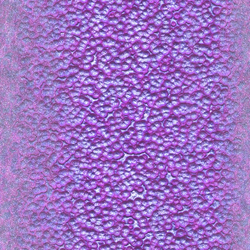Variation 1