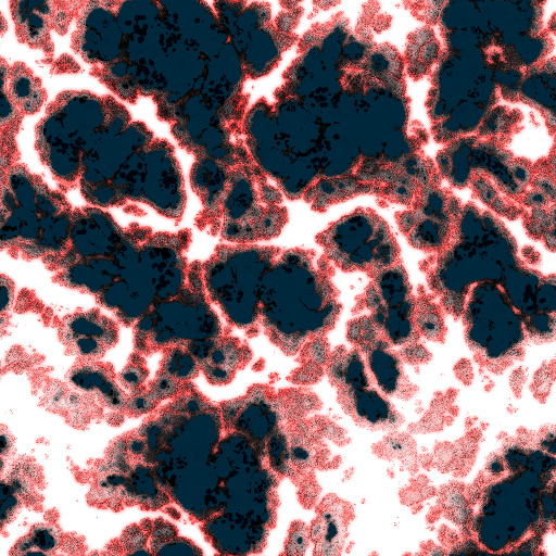 Variation 1