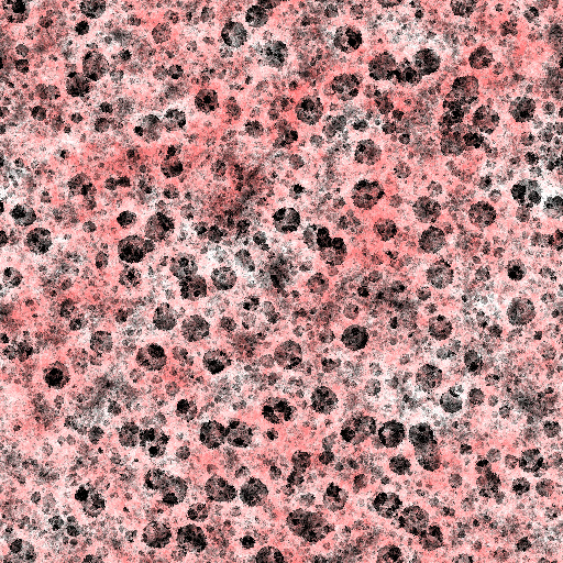 Variation 1