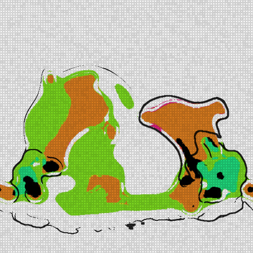 Variation 8
