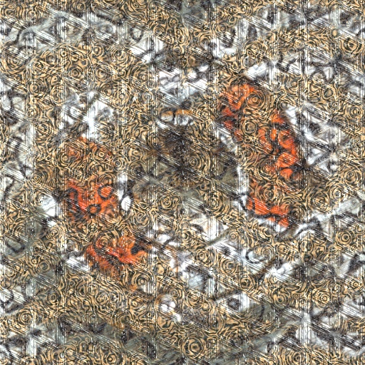 Variation 1