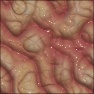 Alien Skin Veins