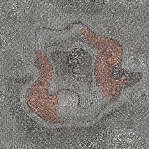 Variation 3