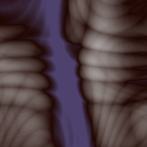 Variation 5