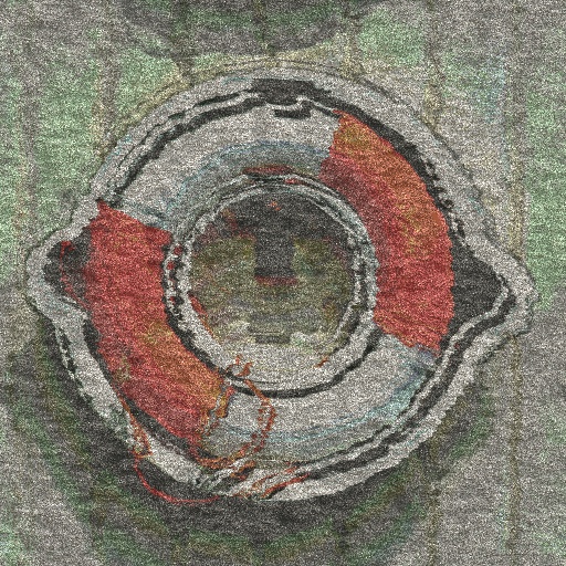 Variation 8