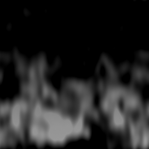 Bump Map