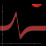Electrocardiogram