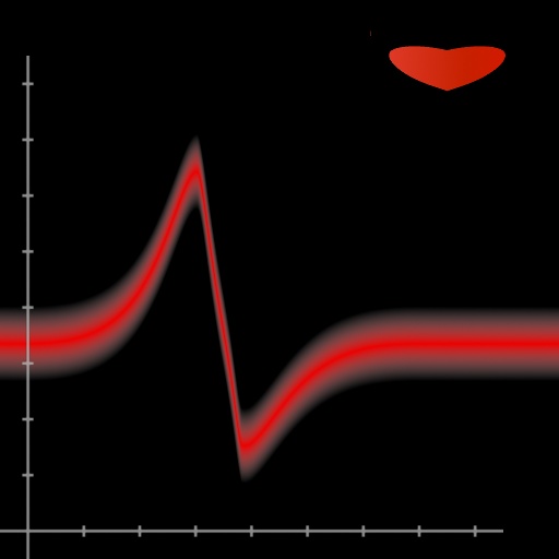 Electrocardiogram