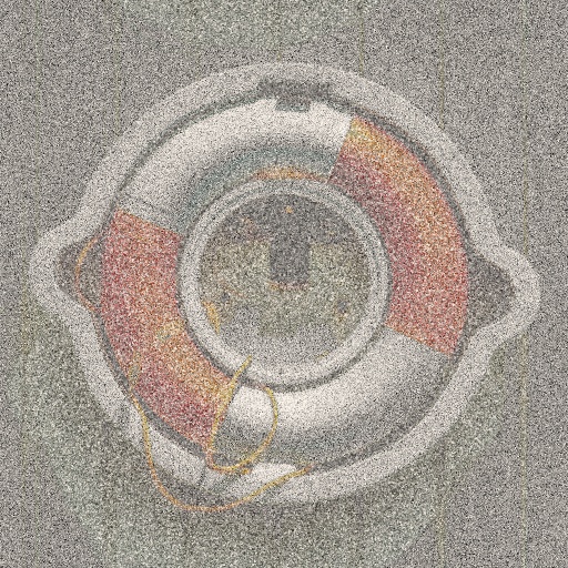Variation 3