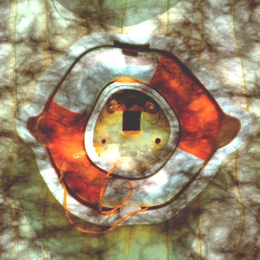 Variation 1