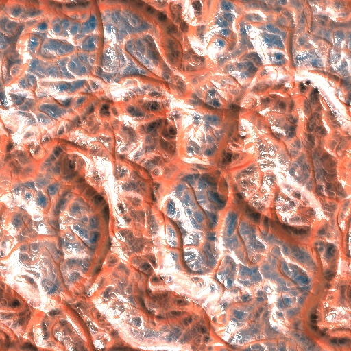 Variation 4