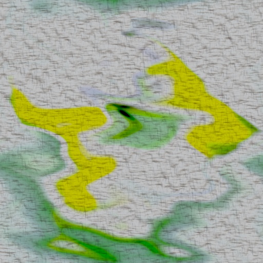 Variation 2
