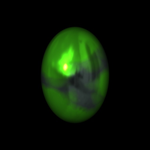Variation 7