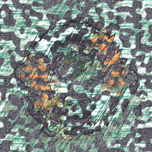 Variation 5