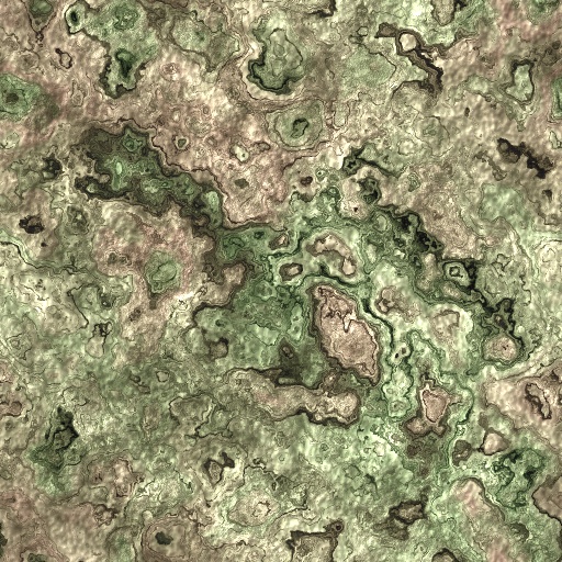 Variation 5