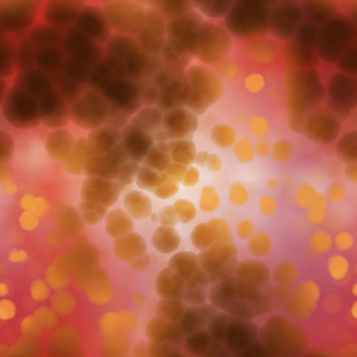 Variation 1