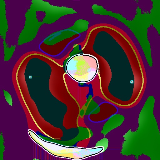 Variation 3