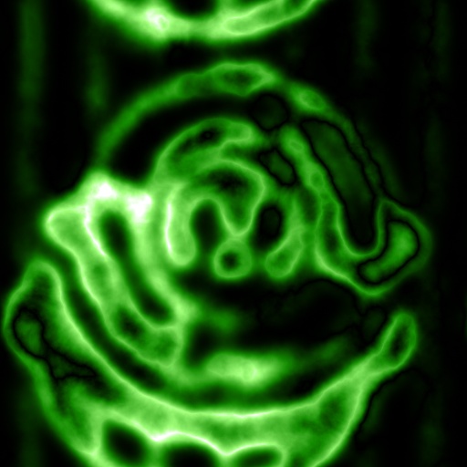 Variation 3