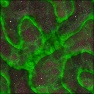 alien infection