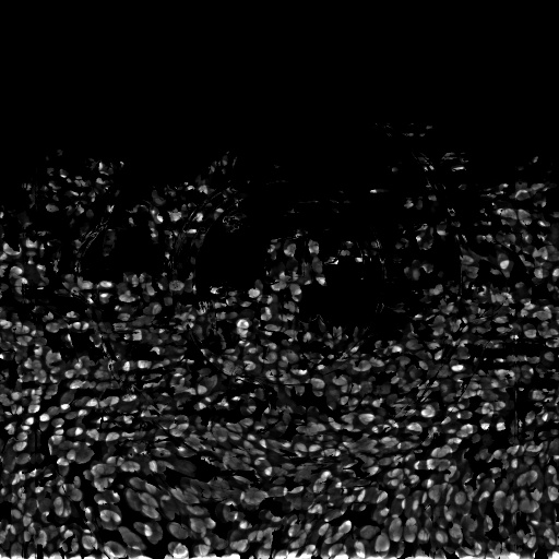 Bump Map