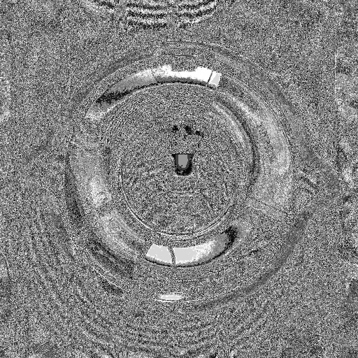 Bump Map