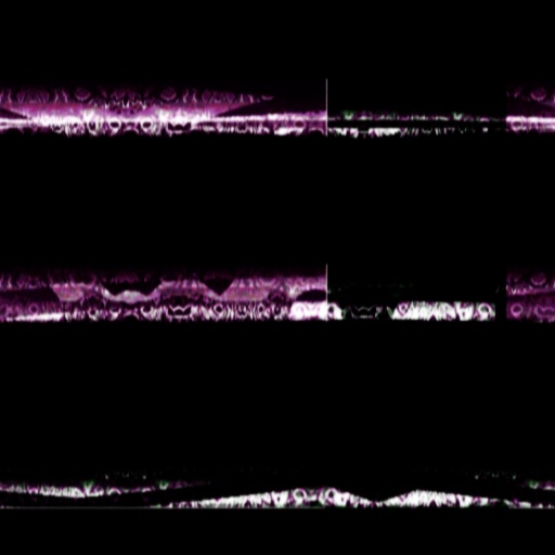 Variation 5