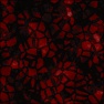 Cystic's Inner Gem